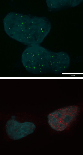 Example of cells that are analysed by immunofluorescence. The top micrograph shows proteins labeled green, and the bottom micrograph shows proteins labeled in red and DNA stained in blue.