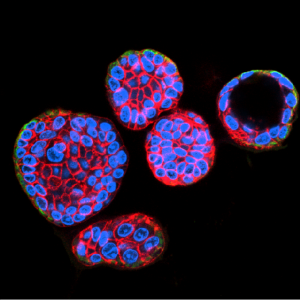 Confocal microscopy images of human intestinal organoids stained for E-Cadherin in red, Keratin-18 in green, and cell nuclei in blue.