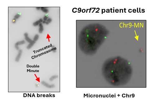 Diagram showing a GGGGCC repeat expansion in the C9orf72 locus causing DNA breaks, chromosomal instability, and micronuclei formation.