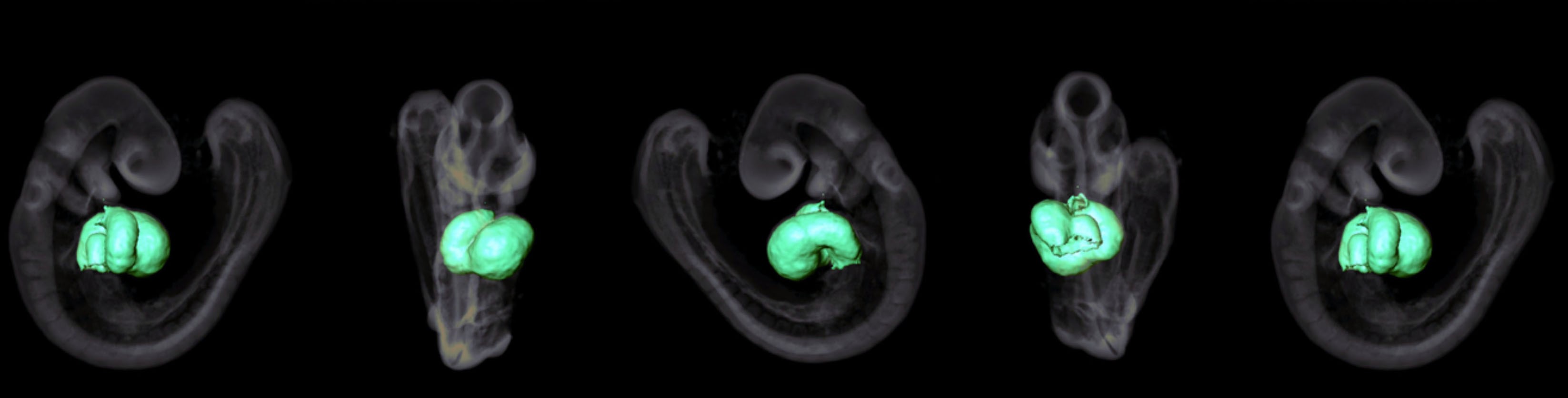 Heart development in a mouse embryo