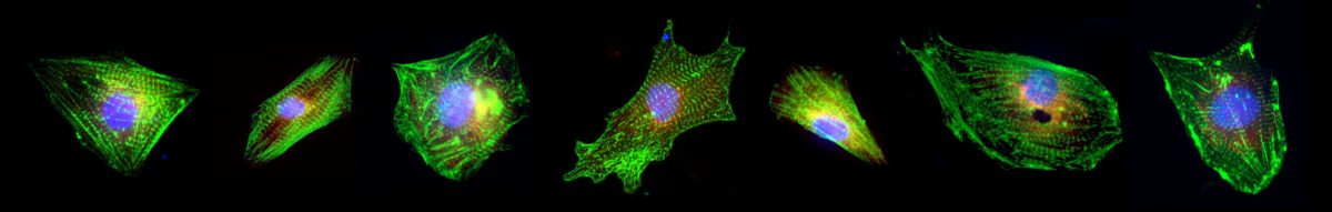 Embryonic cardiomyocytes