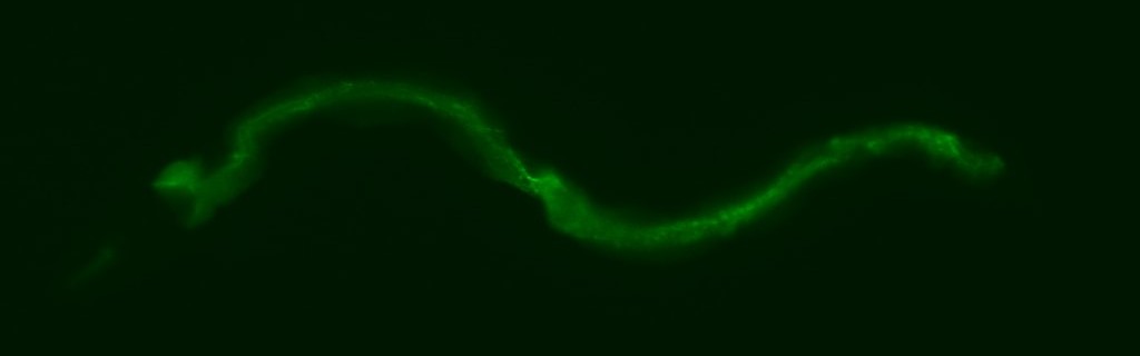 Eric Chapman gfp C.elegans