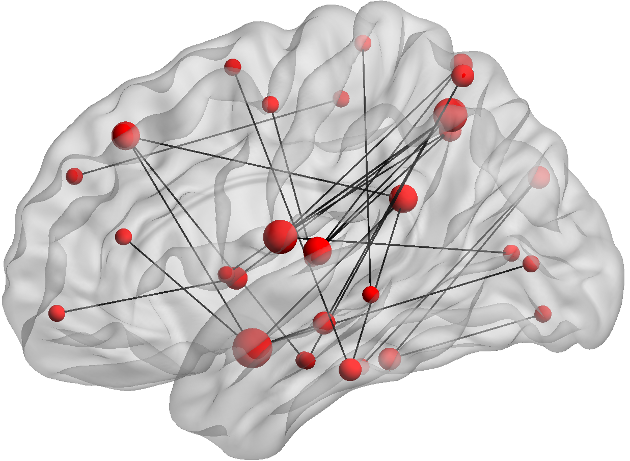 A picture of a brain showing connectivity between nodes.