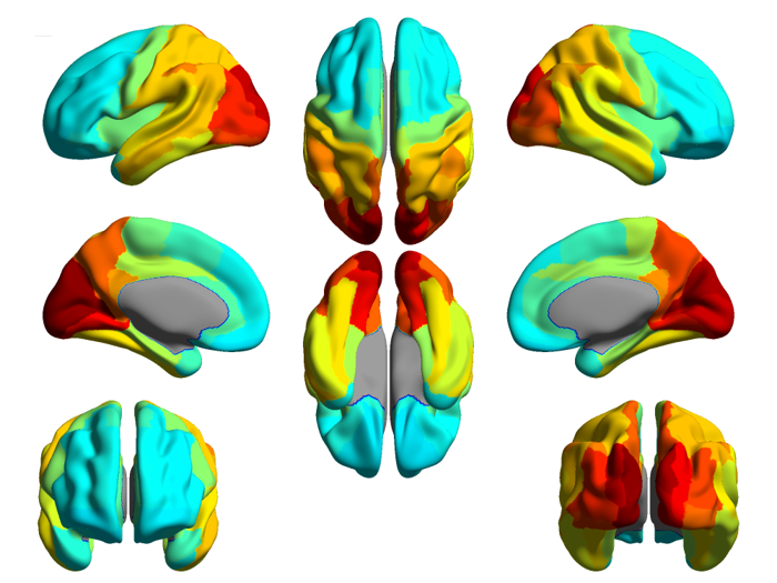 A picture of a brain from 8 perspectives, showing lateral, anterior, posterior, top, and bottom, showing various areas of neuronal activation.