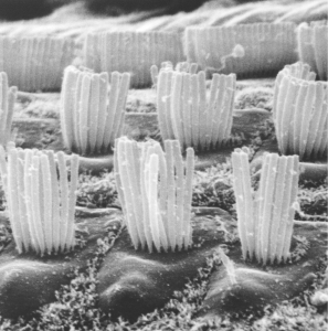 Surface view of outer hair cells