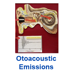 Link to Otoacoustic emissions page