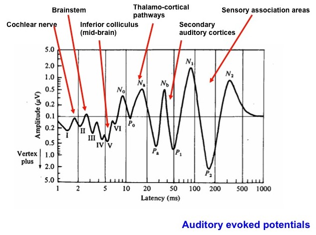 Steady-state auditory evoked responses in audiological diagnosis in  children: a comparison with brainstem evoked auditory responses