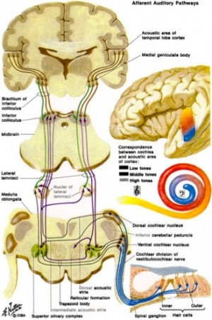 Automated cortical auditory evoked potentials threshold estimation in  neonates☆