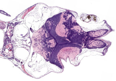 Hematoxylin and eosin (H&E) staining of a tumour-positive zebrafish brain