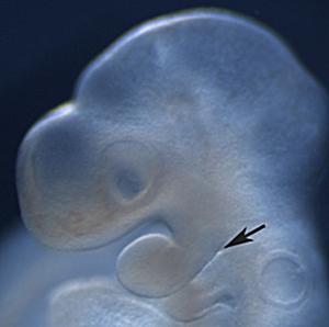 Morphology of a branchial arch in a developing fetus