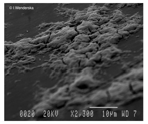 Micrograph of P. aeruginosa biofilm.