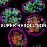 Super resolution microscopes