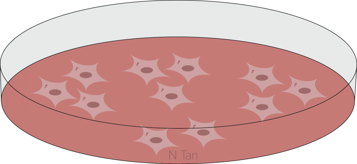 Meredith Irwin Lab – Neuroblastoma Research Program