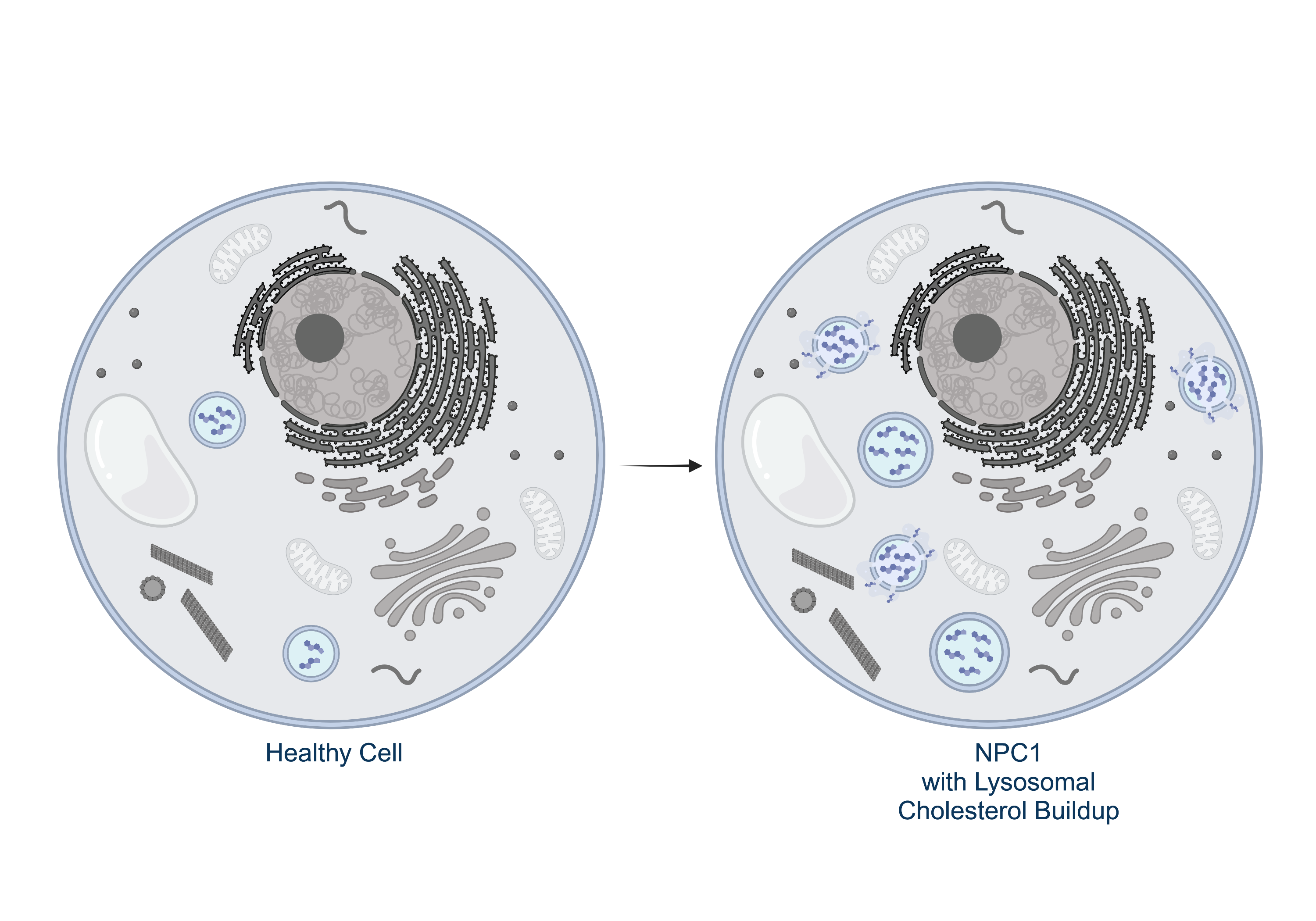 schematic showing lysosomal cholesterol accumulation in an NPC1 cell. Graphics of a healthy cell and an NPC1 cell are displayed, with cholesterol-filled lysosomes being larger and more numerous in the NPC1 cell.