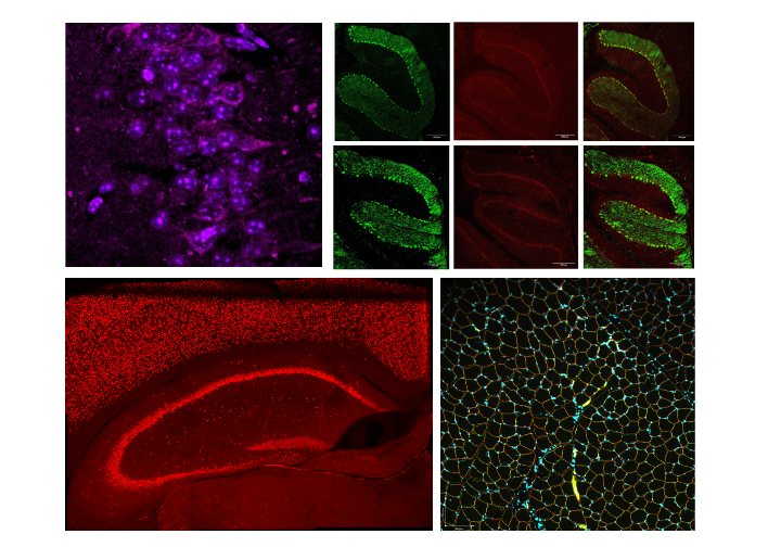 immunohistochemistry images of brain (cerebellum and hippocampus) and muscle tissue from mice. staining shows DAPI and calbindin positive cells in the cerebellum, NeuN positive cells in the hippocampus, and dystrophin and DAPI in muscle tissue.