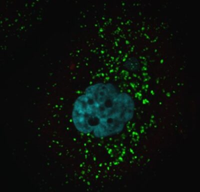 A microscopic image of a cell stained for a lysosomal marker, where the healthy lysosomes within the cell are seen as hundreds of small green dots.