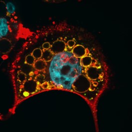A microscopic image of a VacA-treated cell stained for both, a lysosomal marker in green and VacA in red. The enlarged dysfunctional lysosomes are seen as medium-sized yellow circles due to the co-localization of both markers. VacA red staining also delineates the plasma membrane