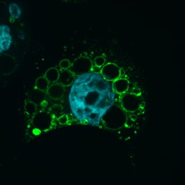 A microscopic image of a VacA-treated cell stained for a lysosomal marker. The enlarged dysfunctional lysosomes or vacuoles are seen as about 20 medium-sized green circles.