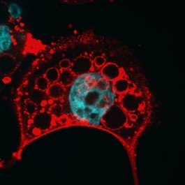A microscopic image of a VacA-treated cell stained for VacA in red. VacA red staining delineates the enlarged dysfunctional lysosomes and the plasma membrane of a cell .