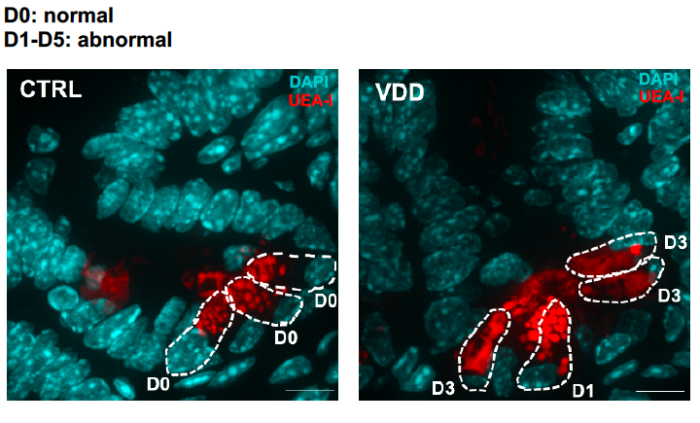 A microscopic image of small intestines obtained from control and vitamin D-deficient mice stained in red for a marker of Paneth cell granules. On the left, in the control small intestine, the red clusters of Paneth cell granules are homogenous in size and number. On the right, red clusters of Paneth cell granules are larger or diffuse in the vitamin D-deficient mouse.