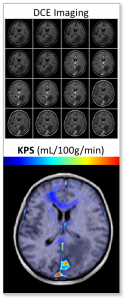 A graphic depicting contrast enhanced imaging at multiple time points, followed by the corresponding KPS map