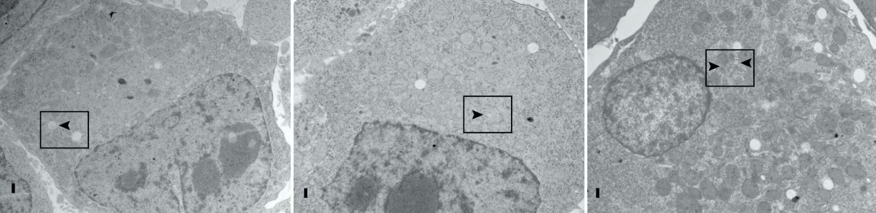 Image shows pictures of cells generated using electron microscopy.