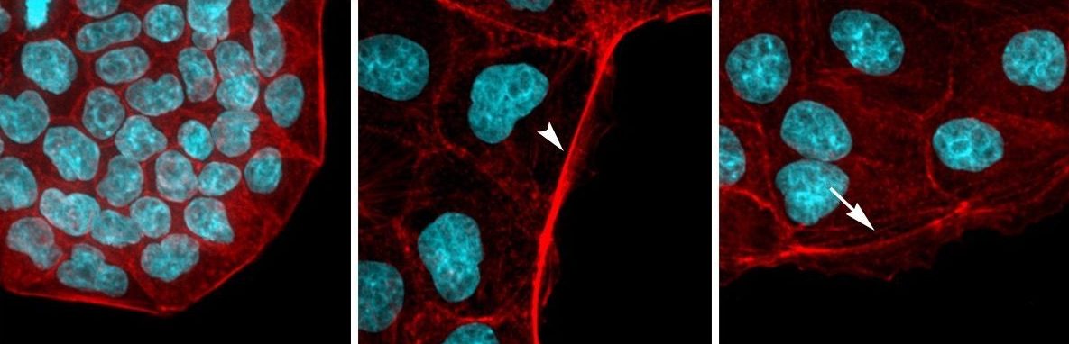 Image shows pictures of cells generated using immunofluorescence and confocal microscopy.