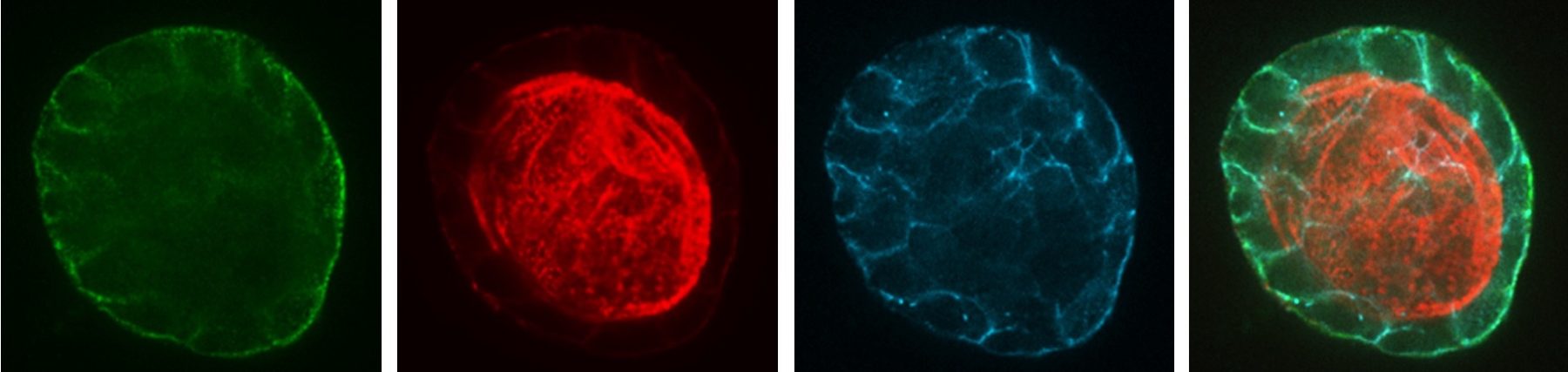 Image shows pictures of cells generated using immunofluorescence and confocal microscopy.