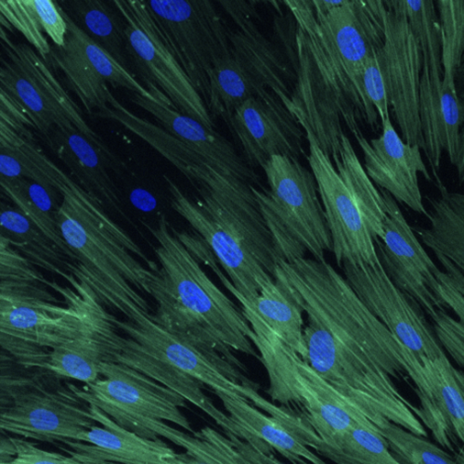 iPSC derived smooth muscle cells labeled with SM22 alpha