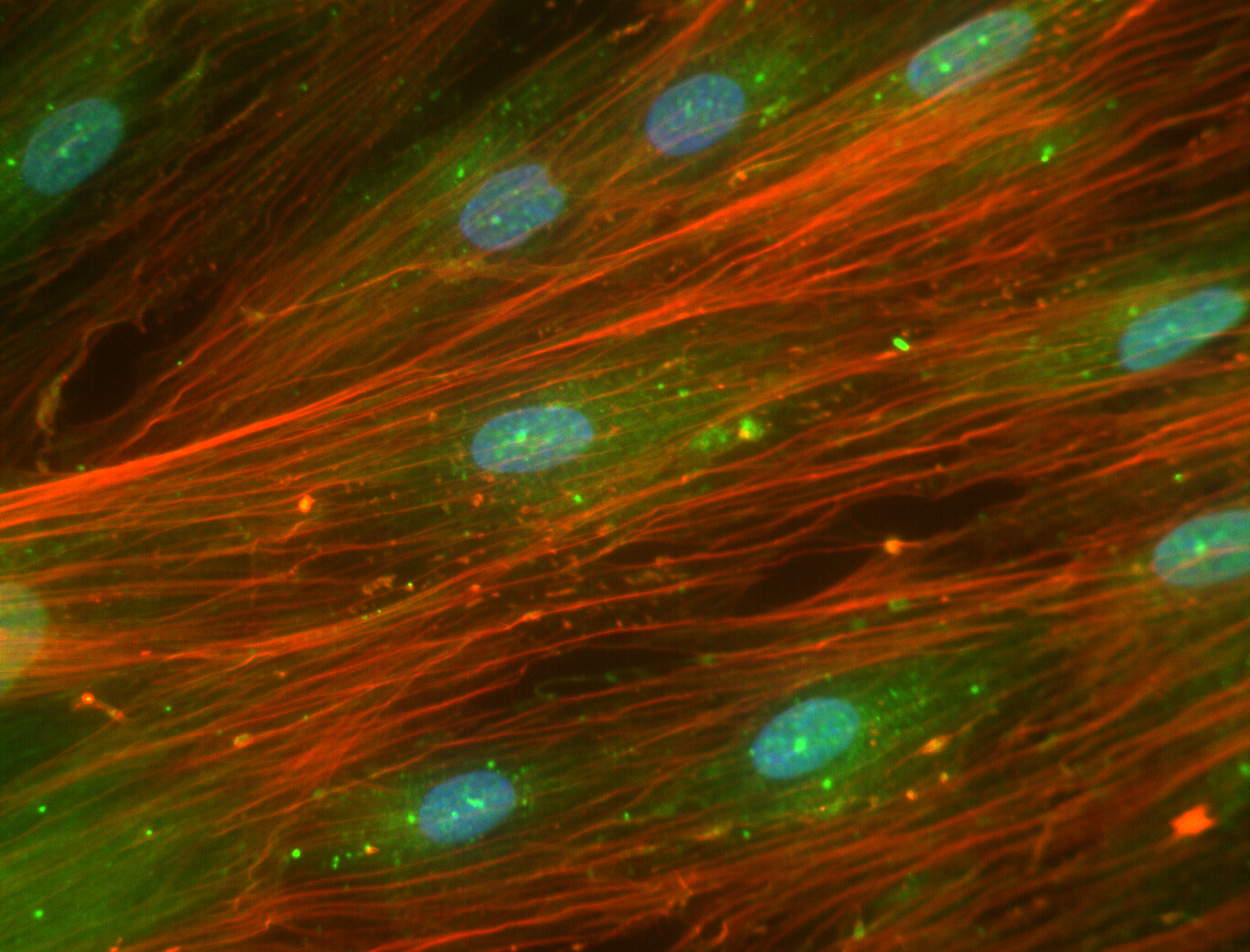 iPSC derived smooth muscle cells labeled with smooth muscle actin and elastin