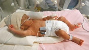Photo of baby in incubator with hat on