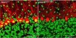 Two images showing Purkinje cells (red)in the mouse cerrebellum. Image to the left show MATR3 (green) is localized in the nucleus of the cell bodies in the wild-type mice. Image to the right show loss of nuclear MATR3 was observed in the degenerating Purkinje cells in the mutant mice.