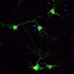An image of green cortical neuron on a black background.
