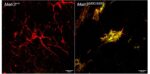 Two images showing microglia in wild-type and MATR3 S85C knock-in mouse cerebellum. Microglia morphology is changed in the mutant mouse brain, showing enlarged cell bodies and retraction of processes.