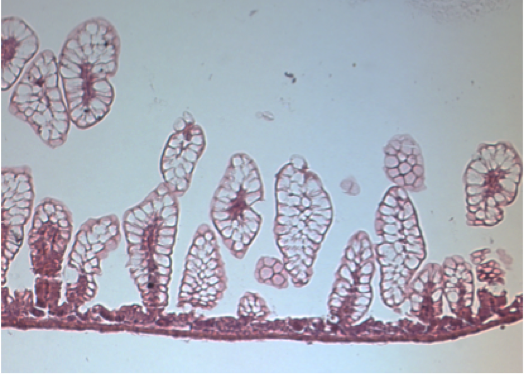 Hematoxylin and eosin staining image of vili in the ileum damaged during experimental Necrotizing Enterocolitis