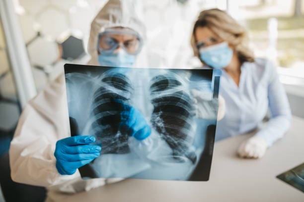 Photo of researchers looking at lung x-ray