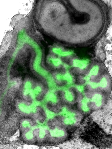 Kidney explant with green colour highlighting branches
