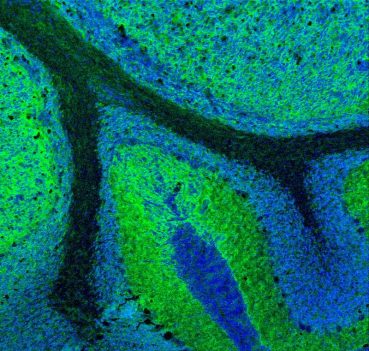 Staining for Sirpα (green) for neurons and DNA (green) of normal cerebellar and medulloblastoma tissue by imaging mass cytometry