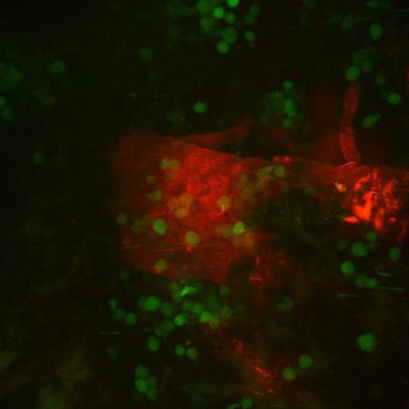In vivo live imaging of GFP+ medulloblastoma cells (at 20X) in the leptomeningeal space next to the spinal vein (TRITC+) via a surgically implanted spinal window