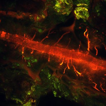 In vivo optical imaging to visualize medulloblastoma metastasis (DaCosta/Taylor Lab Collaboration)