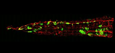 Confocal image of whole-mount spinal meninges labelled for Math1-GFP metastatic tumour cells (green) and meningeal blood vessels (red) in a transgenic medulloblastoma mouse model.