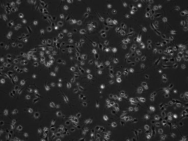 Patient-derived paediatric PFA ependymoma cell lines grown under hypoxic conditions display distinct morphologies (10X).