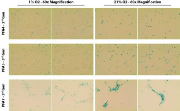 Increased senescence as seen by XGal staining of PFA cells cultured in 21% compared to 1% oxygen.