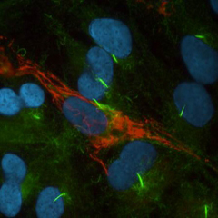 Image of cells showing Primary Cilia with acetylated tubulin in green and septin in red