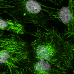 Cells with Septins stained in green, nucleus in grey