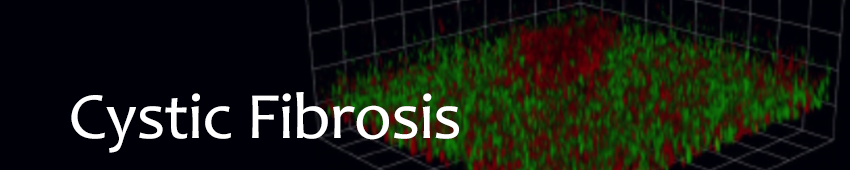 Background banner Image of graphs with Cystic Fibrosis Text