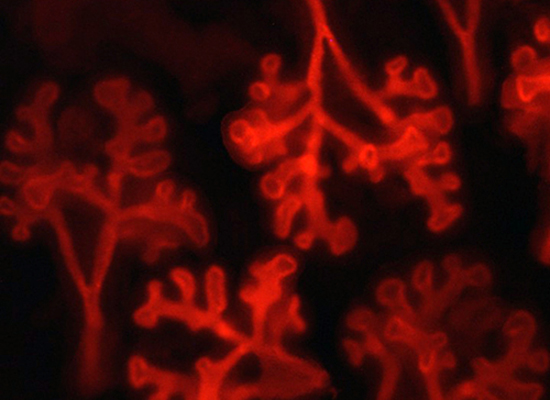 Mouse lungs during fetal development at embryonic day 12.5. Using the Nkx2-1-IRES-mCherry reporter mouse line, the developing lung can be visualized under fluorescence microscopy showing beautifully branched structures that will continue to grow and expand reminiscent of the upside down tree. Courtesy of Drs. Janet Rossant & Melanie Bilodeau.