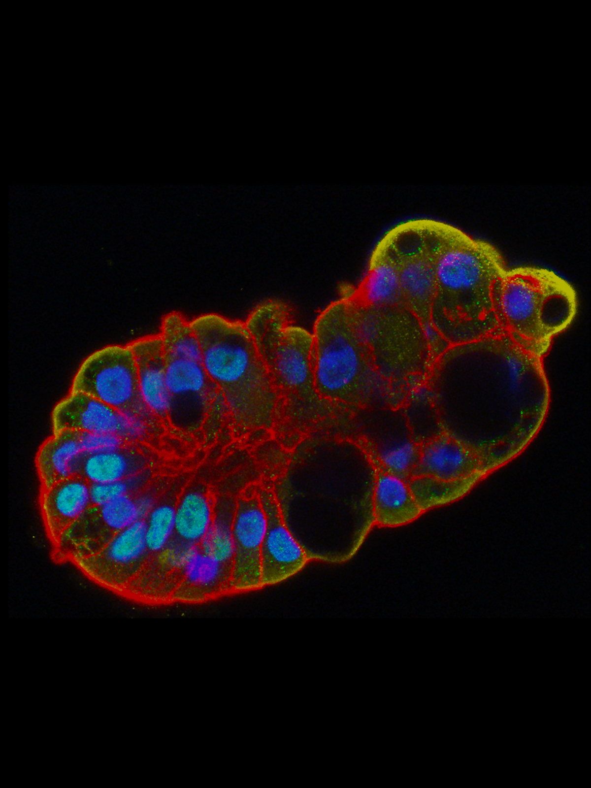 Main page slider image of the lung organoid.