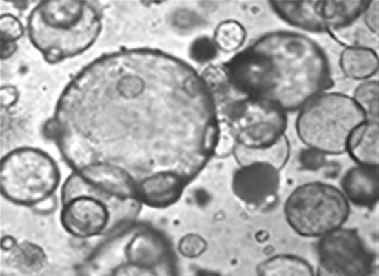 Pluripotent stem cell-derived airway organoids grown in semi-solid suspension.