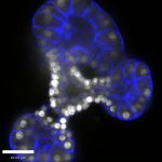 Branching human airway organoids